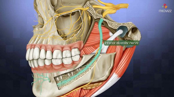 下齒槽神經-神經阻斷